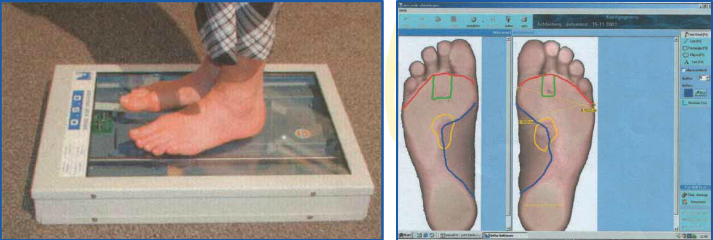 Lodewijks Orthopedie NV Voetscan